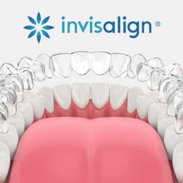 What-Makes-Invisalign-Stand-Out-for-Treating-Misaligned-Teeth
