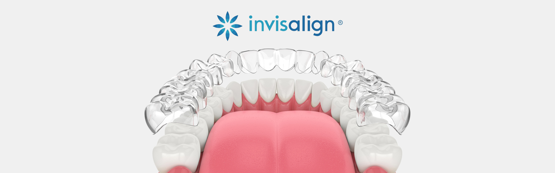 What-Makes-Invisalign-Stand-Out-for-Treating-Misaligned-Teeth